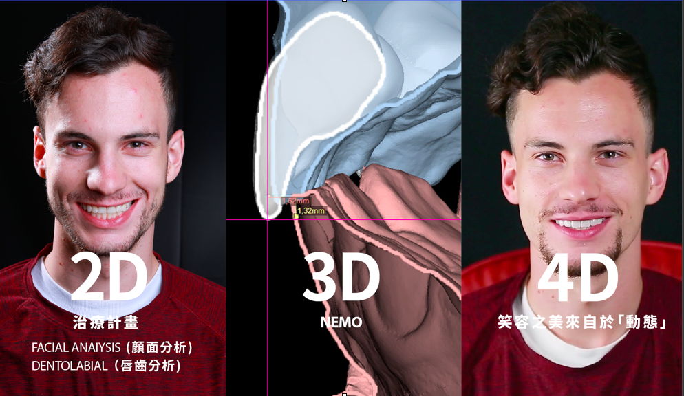 從2D到4D的雙向治療計畫 | 顏面導向的齒顎矯正計畫 | 馬永昌醫師