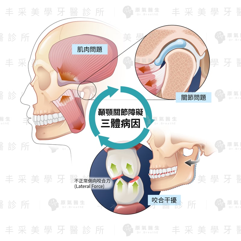 顳顎關節障礙病因