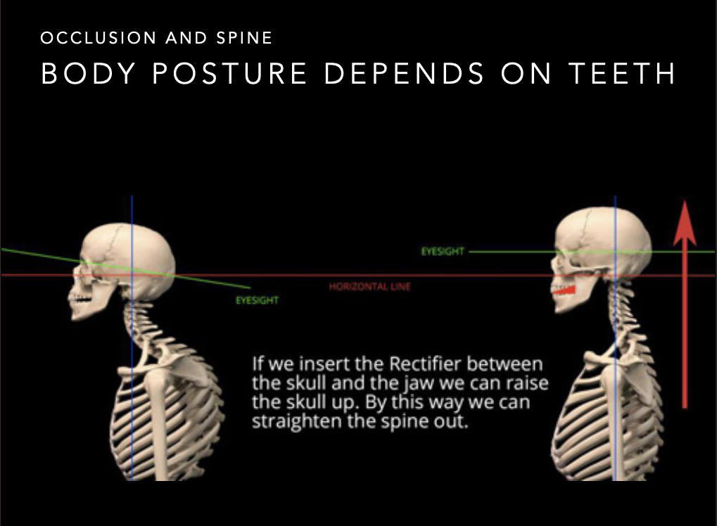 blog-body posture depends on teeth