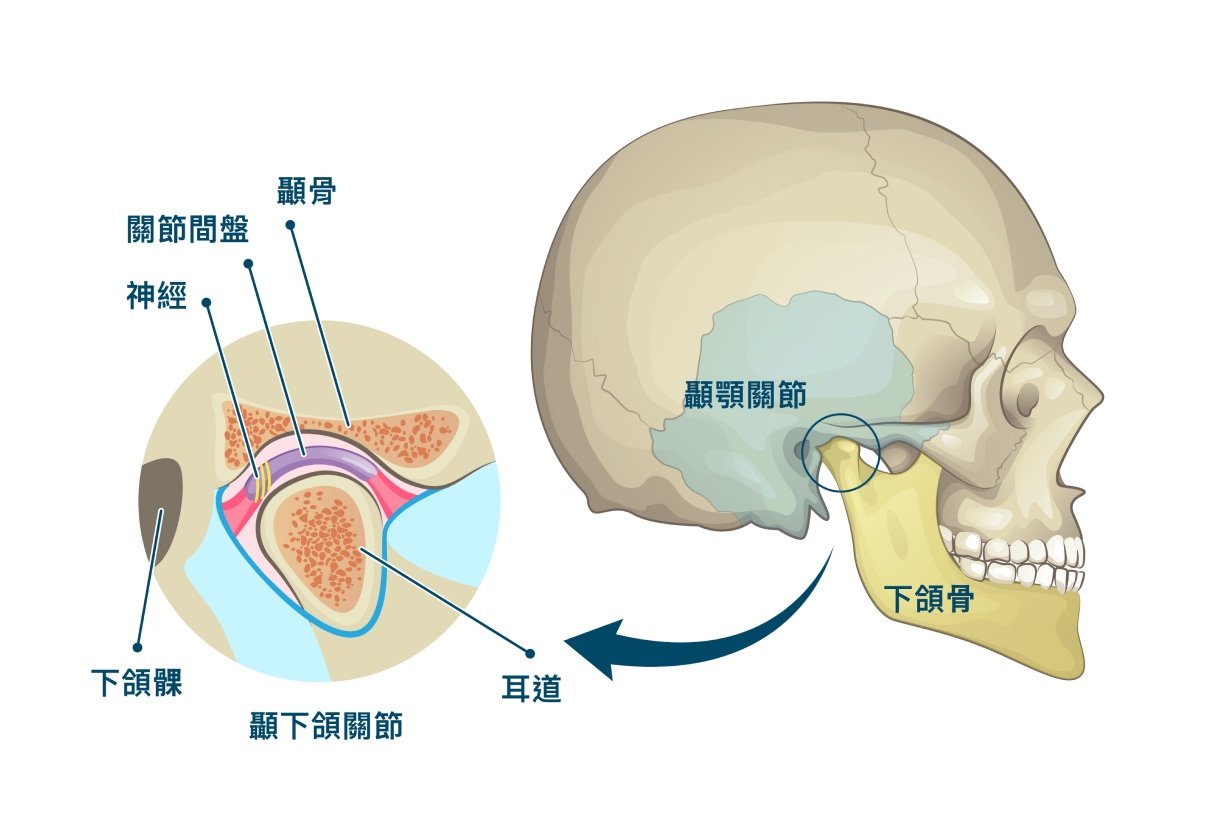 TMJ｜TMD｜顳顎關節症候群