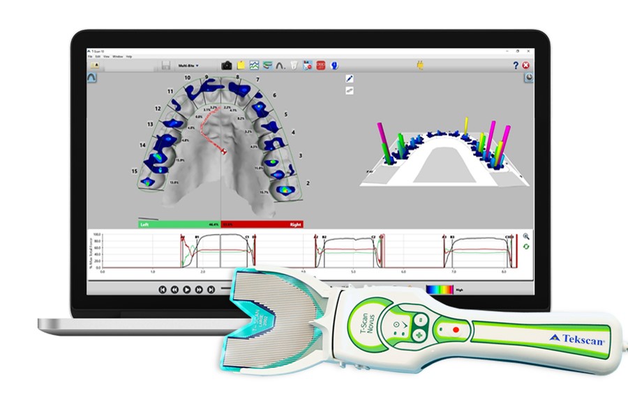 T-Scan電腦咬合分析