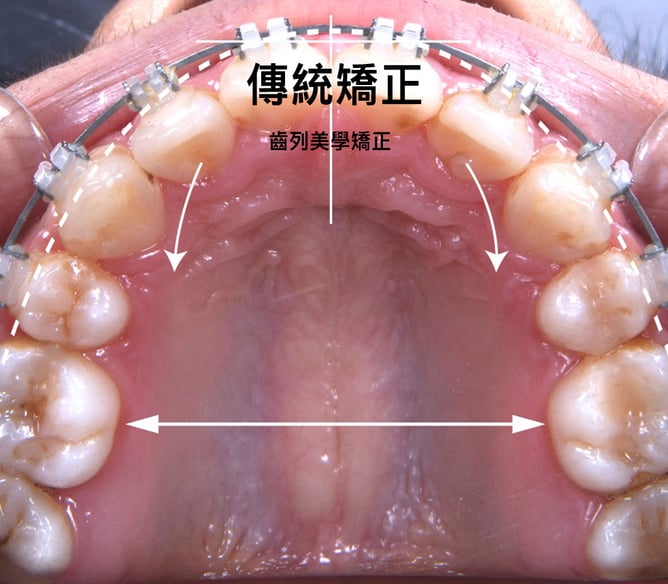 傳統矯正-1