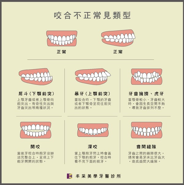 咬合不正常見類型
