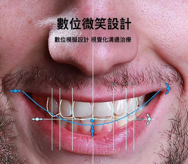 數位微笑設計 馬永昌醫師