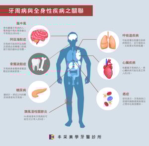 牙周病與全身疾病表-01-1-Aug-08-2022-11-34-06-36-PM