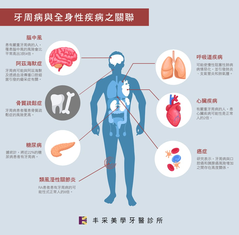 牙周病與全身疾病圖表 丰采美學牙醫診所