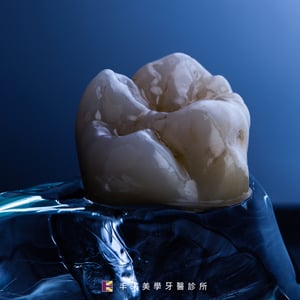 氧化鋯全瓷假牙 丰采美學牙醫
