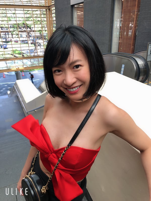 瓷牙貼面 馬永昌醫師