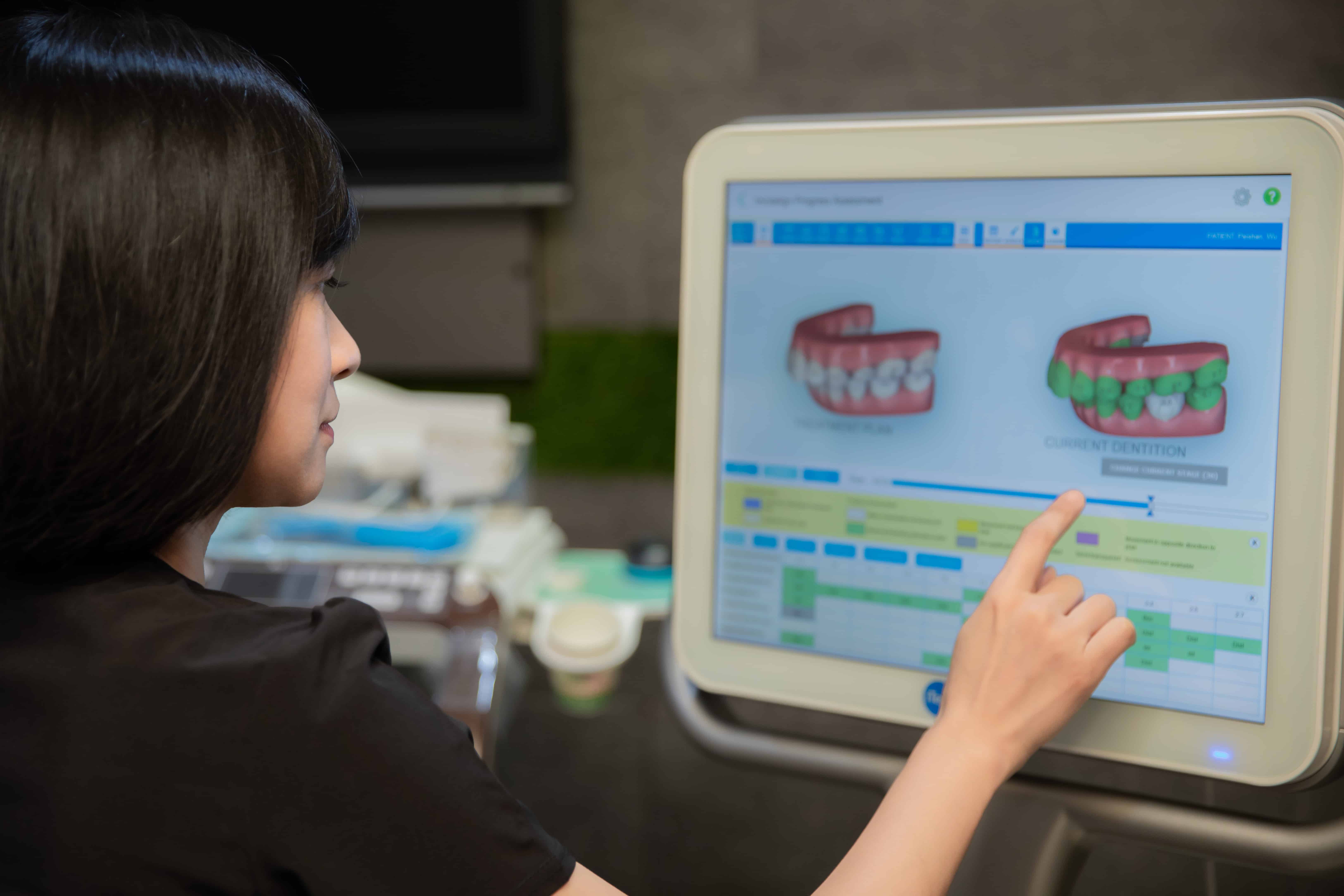 DR.EMMA蔡宜均醫師使用ITERO數位口掃機幫患者做電腦模擬矯正流程