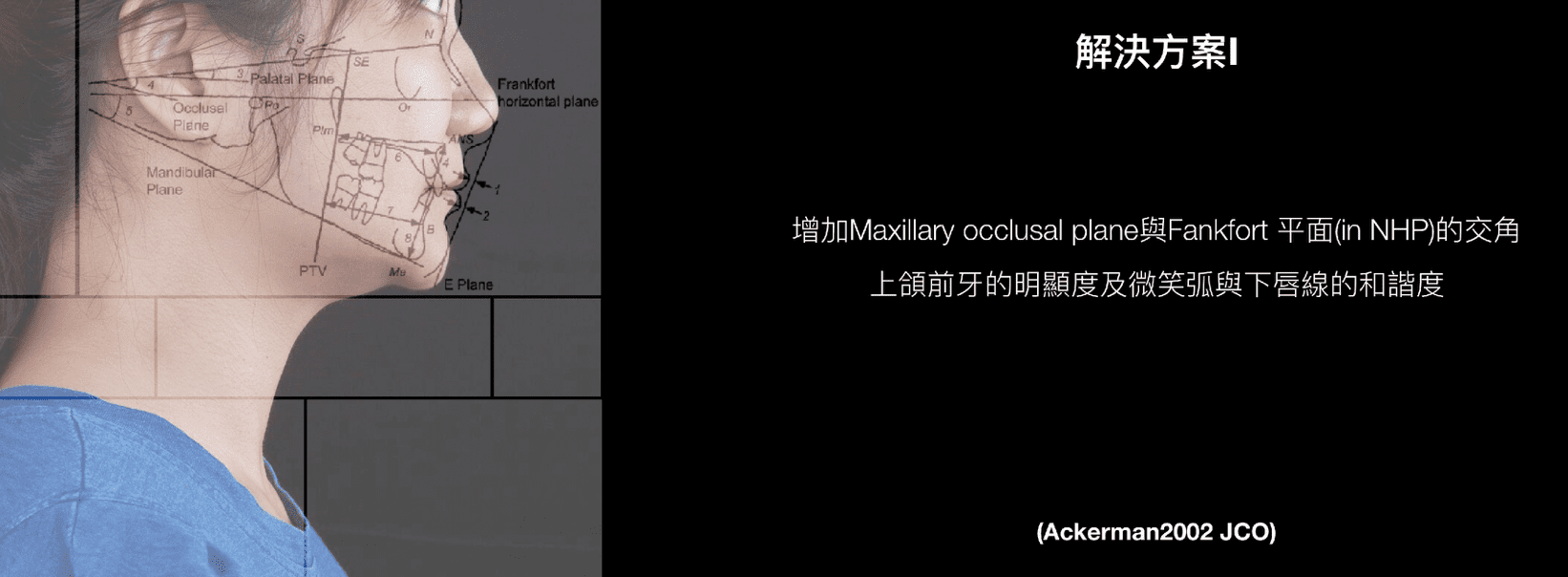 矯正牙套與臉型解決方案