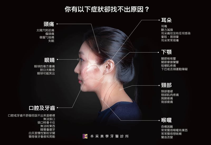 顳顎關節症候群