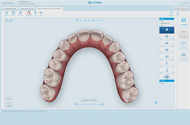 Invisalign｜隱適美｜丰采美學牙醫