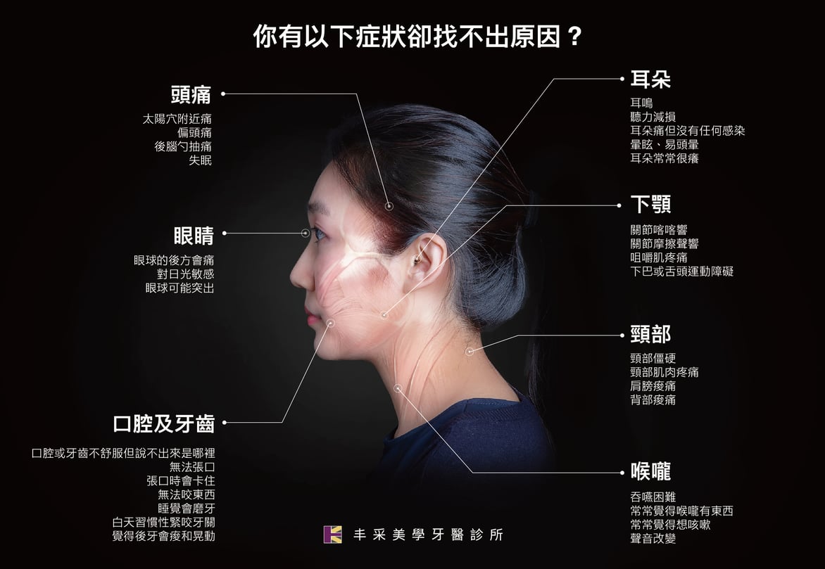 顳顎關節炎 頭痛 耳朵痛 張口卡卡困難 臉歪都可能是顳顎關節症候群徵兆 丰采美學牙醫診所