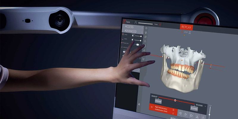 modjaw-analiza-ruchow-szczeki-luxdentica