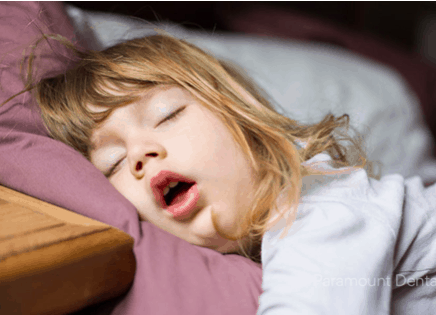 口呼吸與睡眠呼吸中止症孩童常見睡姿