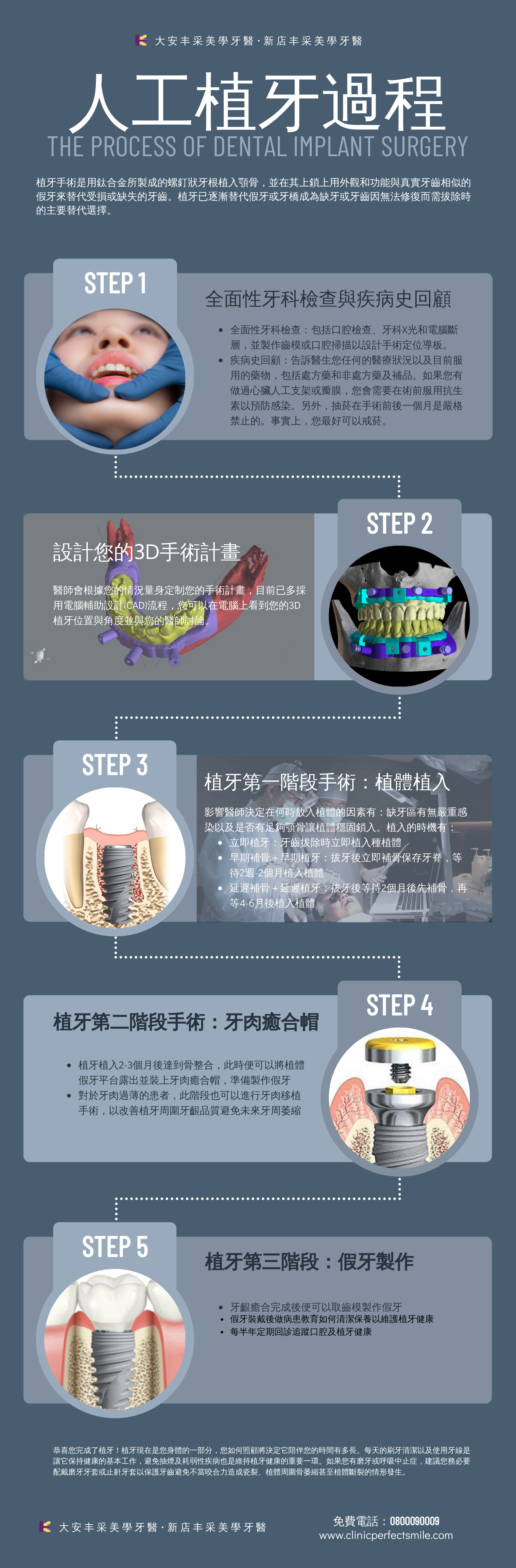 最先進植牙流程是什樣 2021年植牙過程分享 丰采美學牙醫診所