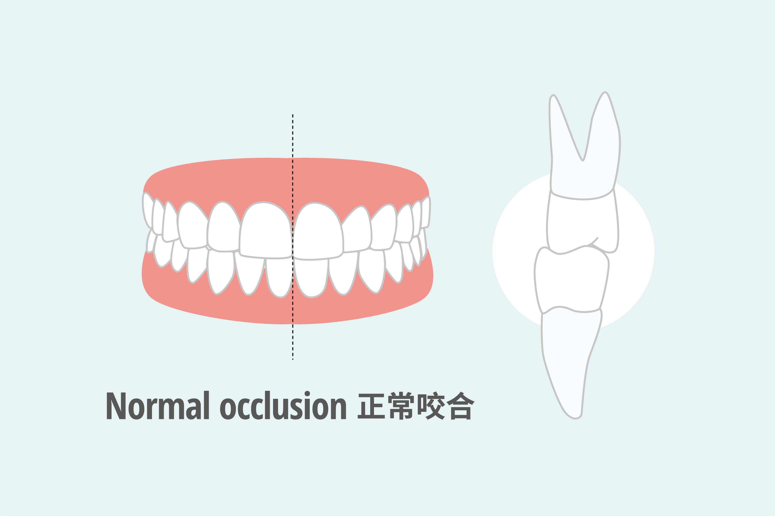 牙齒矯正