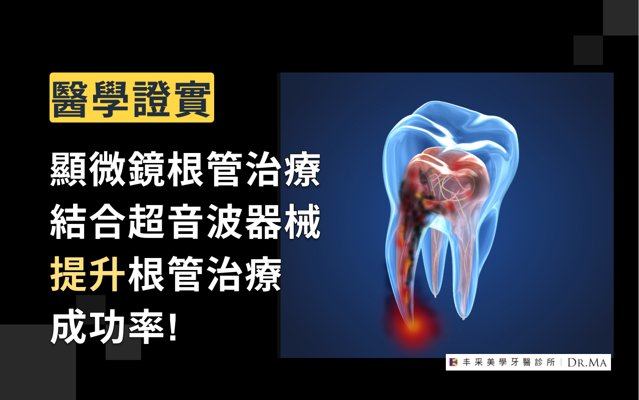 顯微鏡根管治療