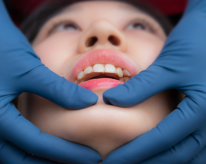 顳顎關節症候群－丰采美學牙醫診所