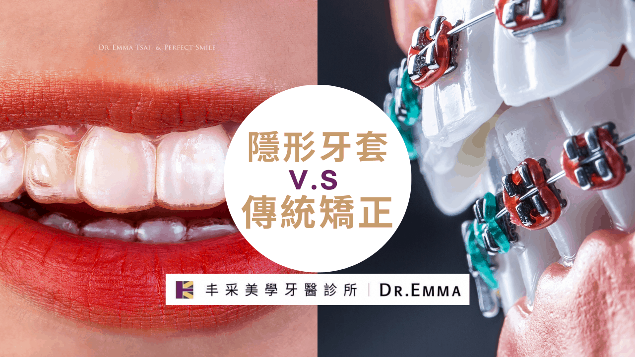 牙齒矯正｜隱適美Invisalign｜白金菁英級認證醫師Dr.EMMA 蔡宜均｜丰采美學牙醫診所