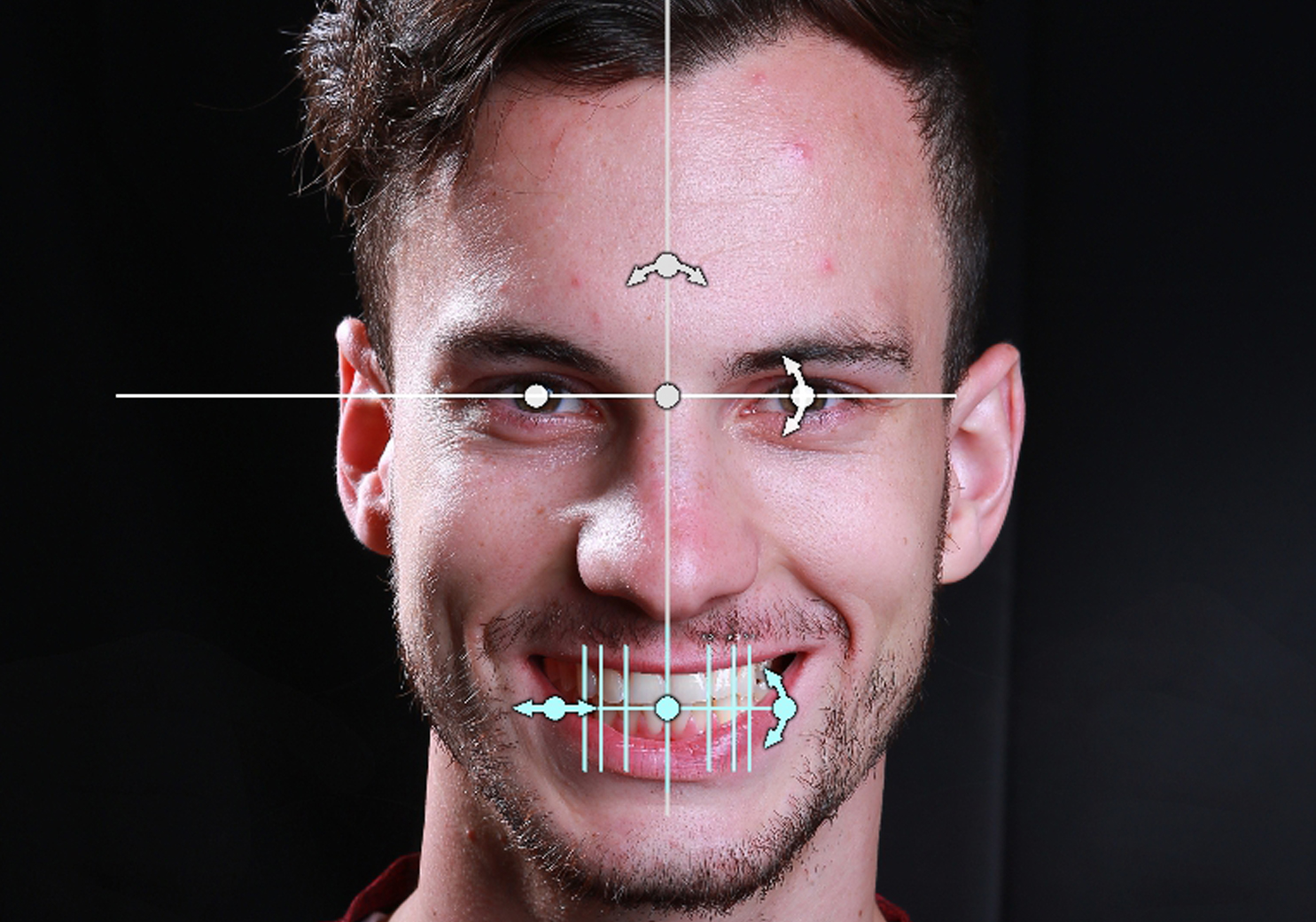 DSD數位微笑設計五官分析 丰采美學牙醫