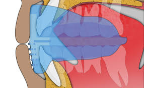 images-2